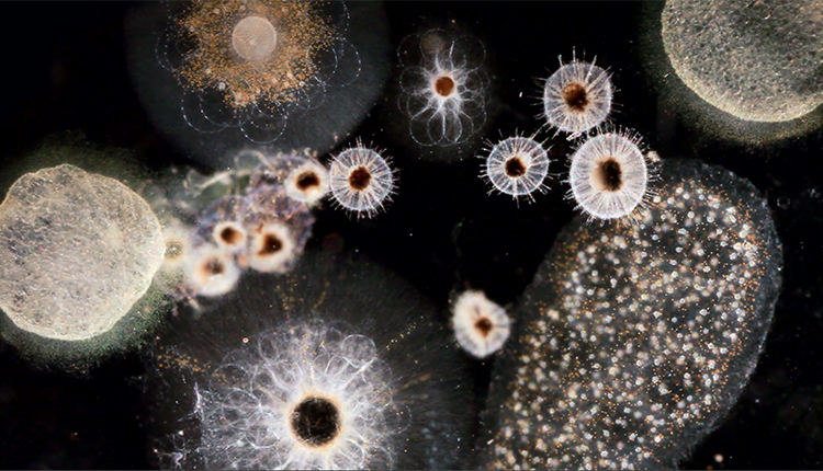  Protiste. Cellules dans la mer © Les chroniques du plancton